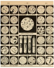 Listing image for Vintage French Science Bacteria Culture Poster Print Wall Art 183 MIC