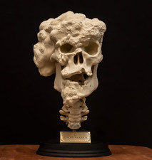Listing image for Joseph Merrick Skull Replica Elephant Man Medical Oddities Display Model new